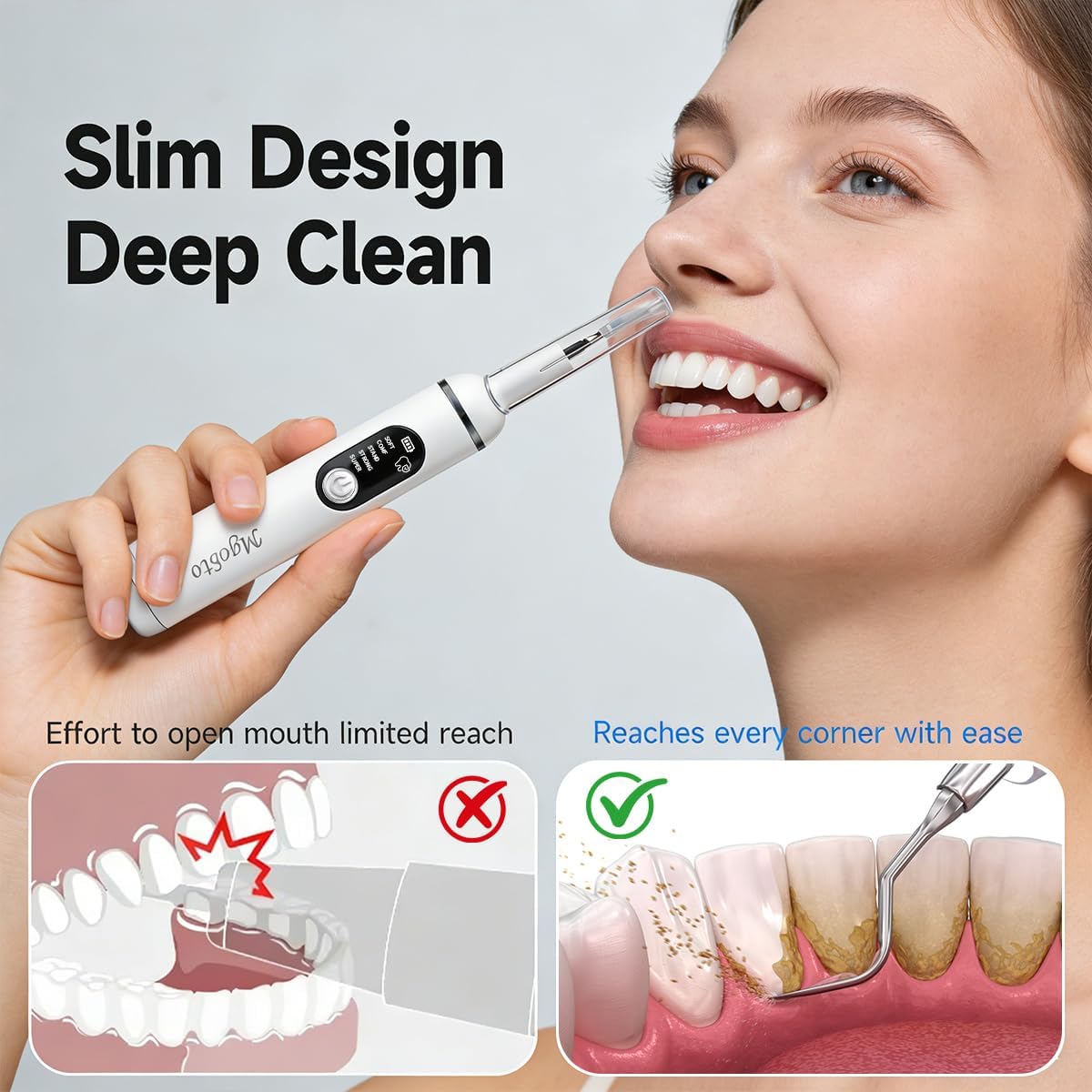 Limpiador dental eléctrico definitivo, limpieza dental ultrasónica,...