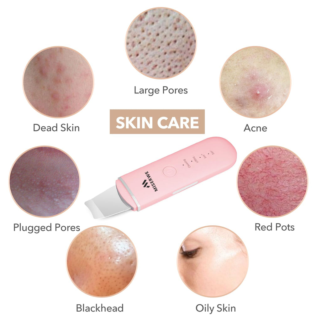 MISERWE - Espátula facial para la piel, limpiador de poros con 4 mo...