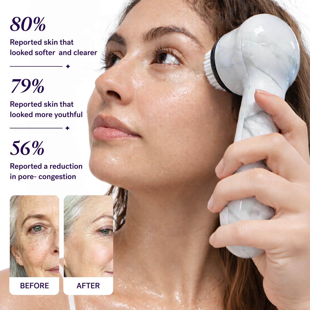 Michael Todd Beauty Soniclear Allure 2026 Readers Choice Winner Son...