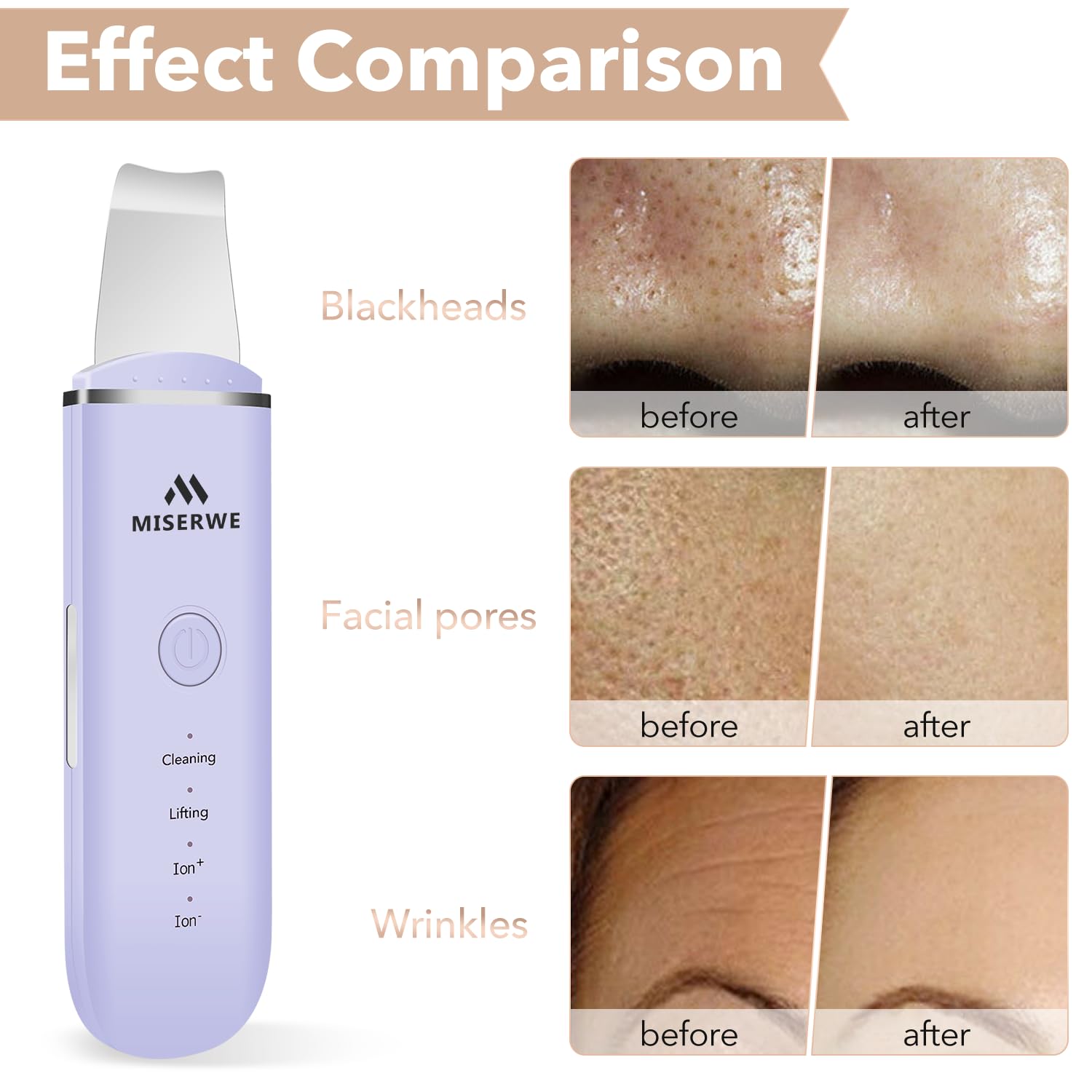 Raspador de Piel Espátula Facial Raspador Facial Espátula para Limp...