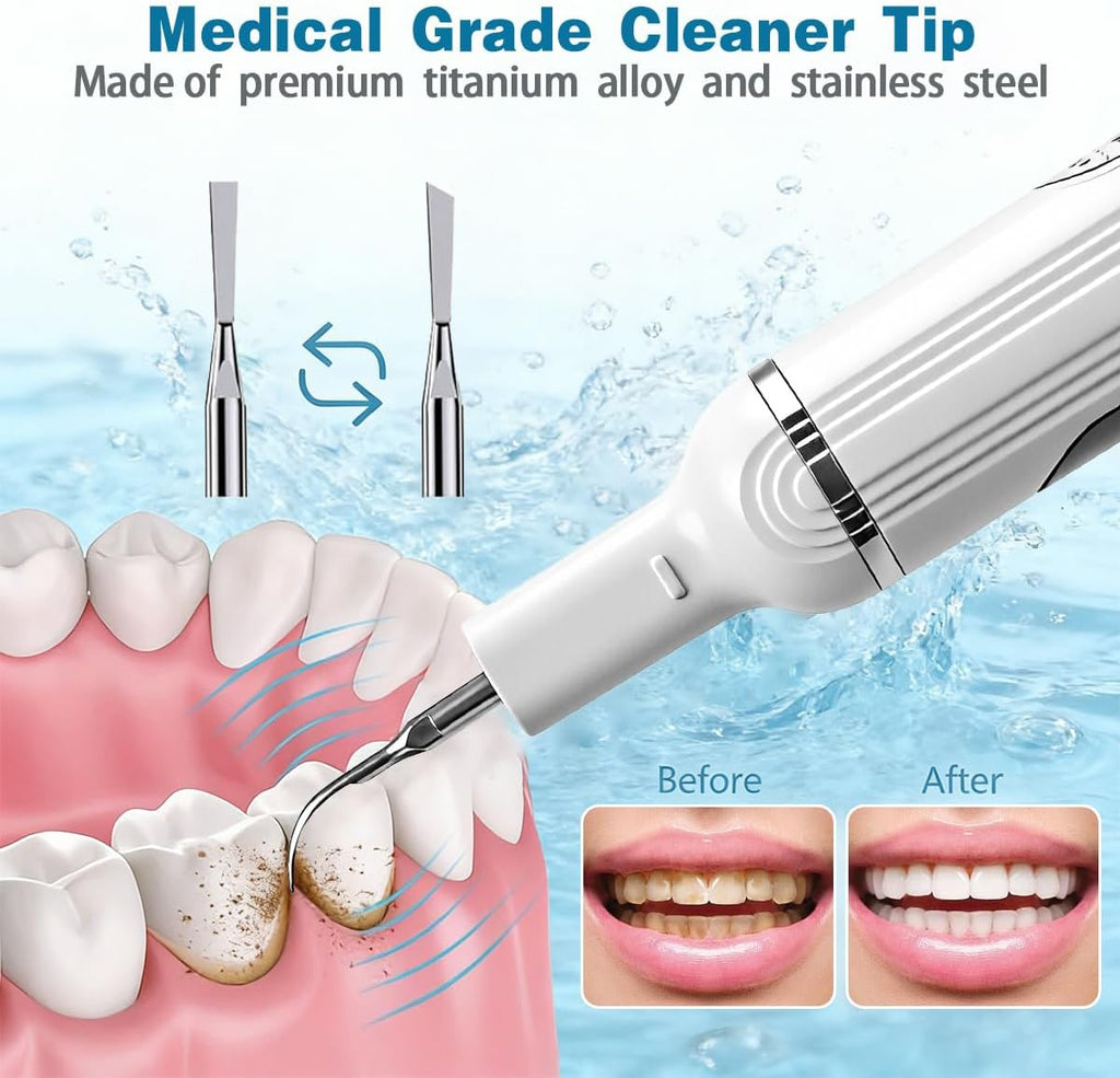 Limpiador dental eléctrico definitivo, limpieza dental ultrasónica,...