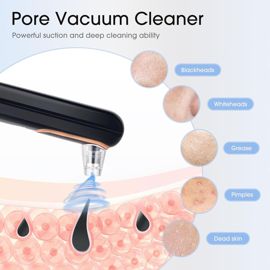 Yccu Removedor de Puntos Negros al Vacío Extractor de Poros Removed...