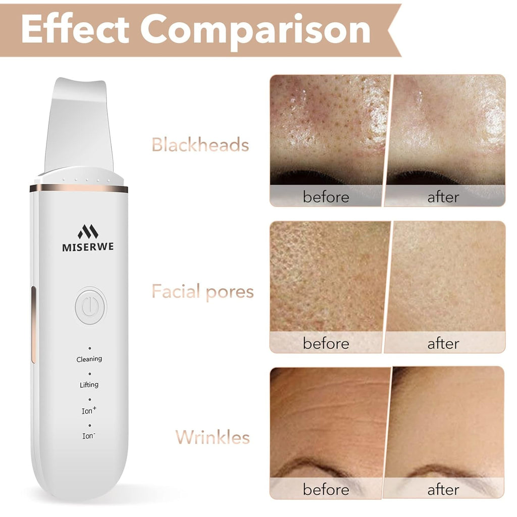 Raspador de Piel Espátula Facial Raspador Facial Espátula para Limp...