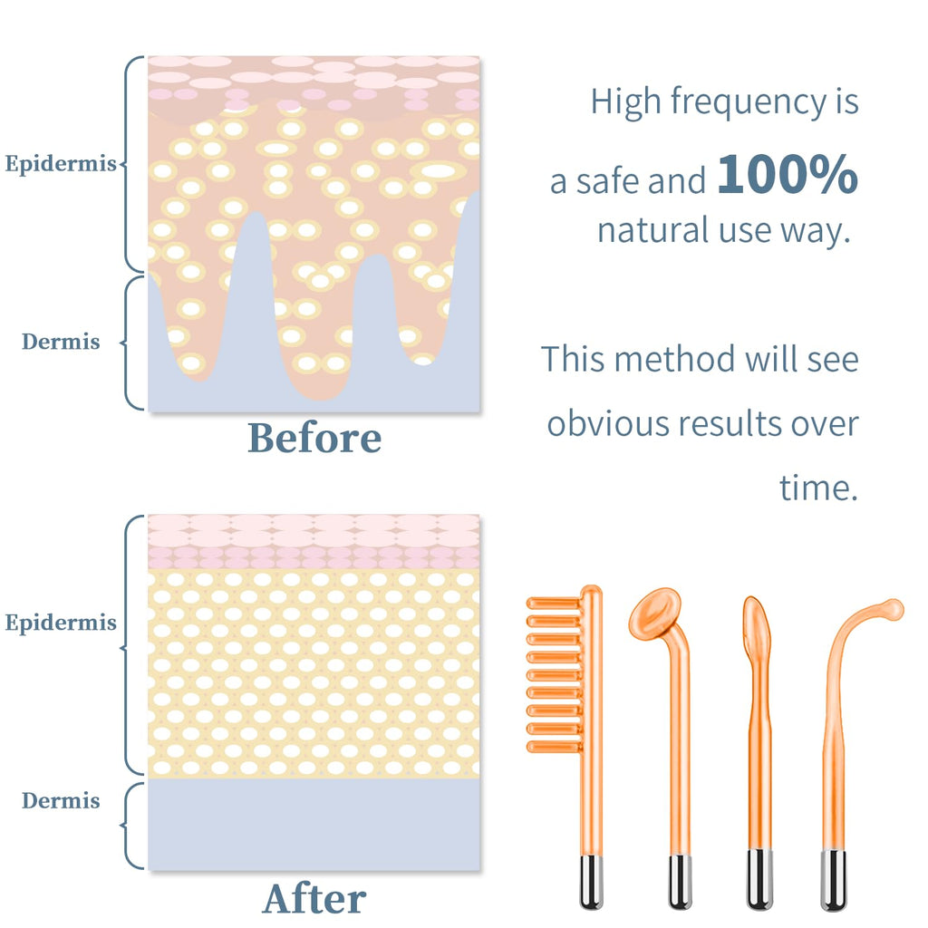 Máquina Facial de Alta Frecuencia - TUMAKOU Máquina Portátil de Man...
