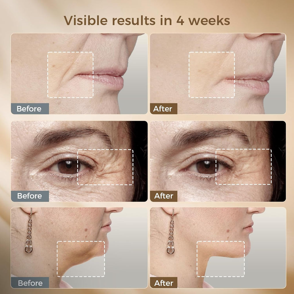 FyneLook Dispositivo facial de microcorriente con terapia de luz ro...