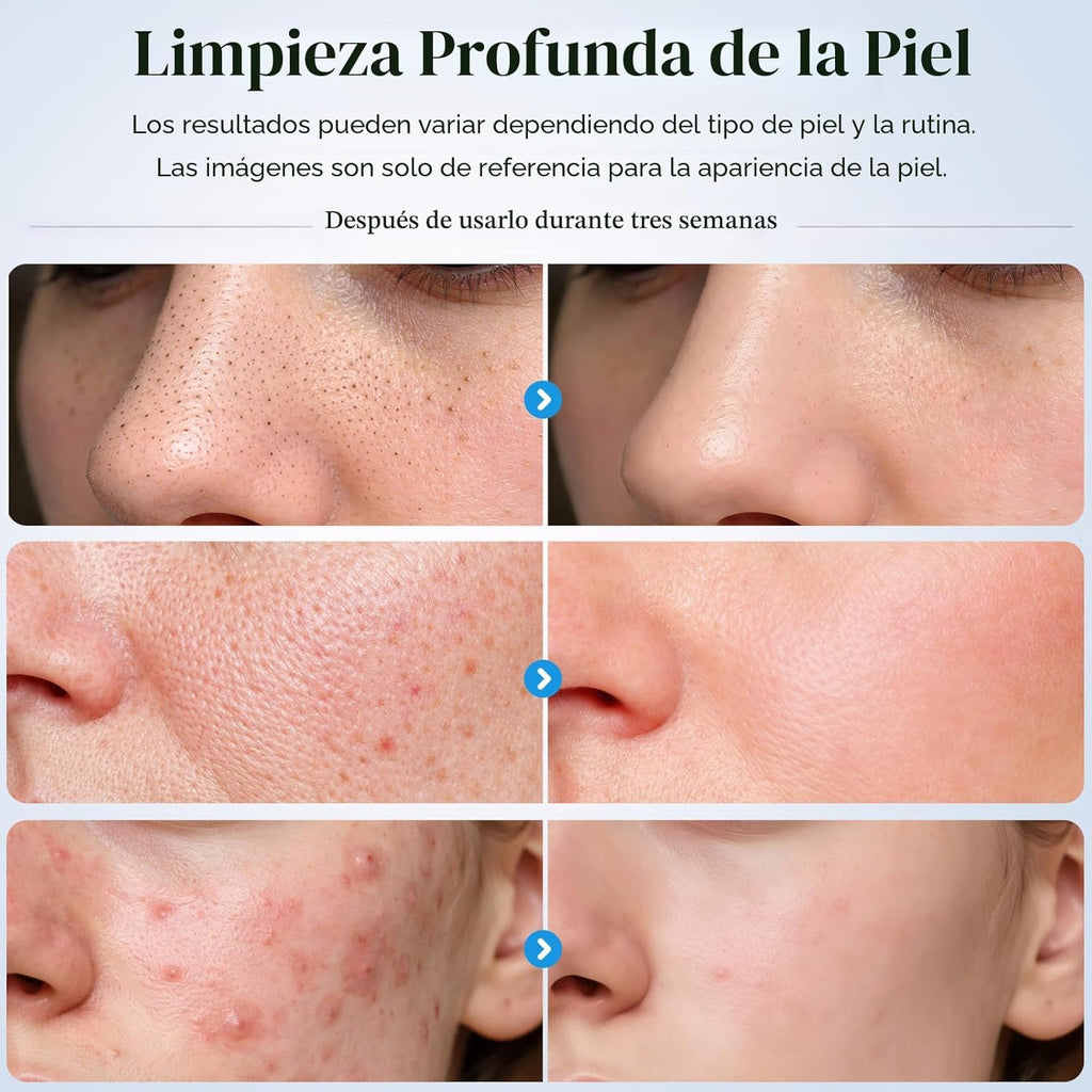 GUGUG - Espátula para exfoliar la piel, espátula facial, limpiador...