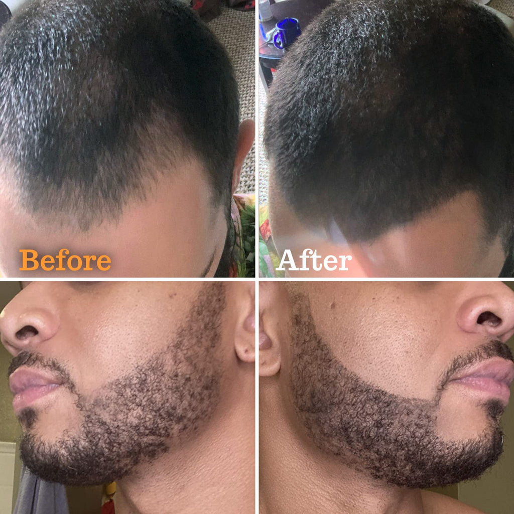 FOLLICLE BOOSTER Pluma Rellenadora de Barba Kit de Peinado para Hom...