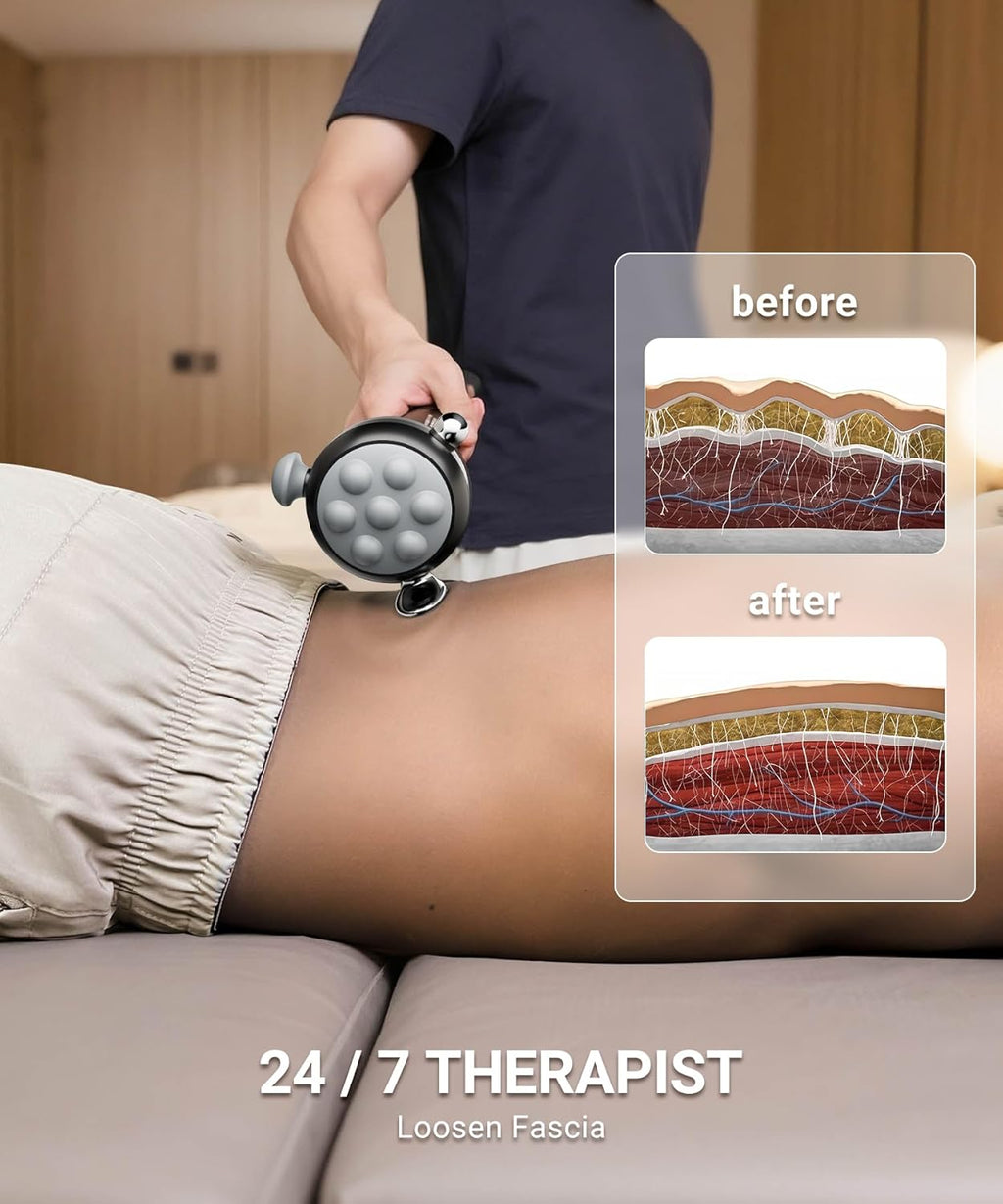 HYAKO Masajeador Pro Max Therapy \u2013 Vibración de tejido profund...