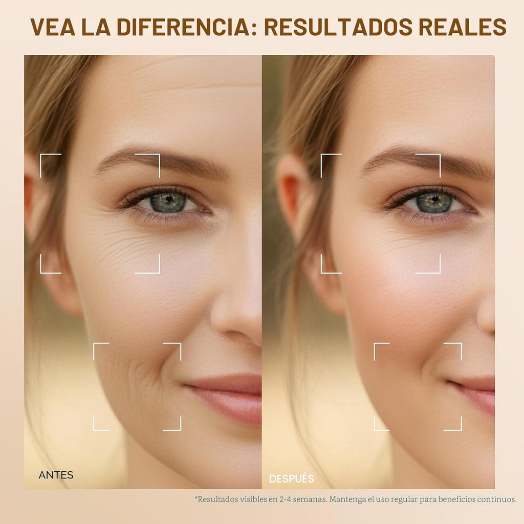 Dispositivo facial de microcorriente con terapia de luz roja \u2013...
