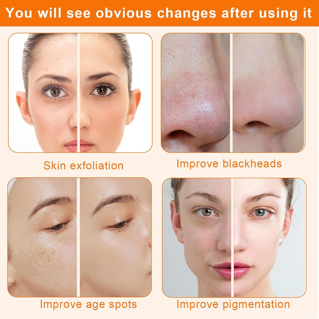 Máquina de microdermoabrasión de diamante, máquina facial de dermoa...