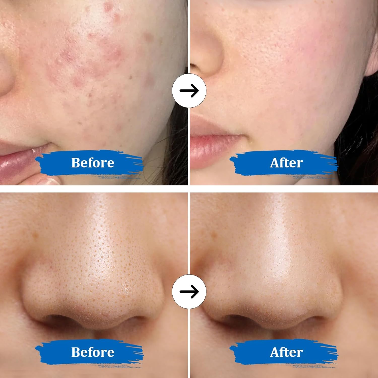 GUGUG Raspador de Piel 4 en 1 Espátula Facial Impermeable para Limp...