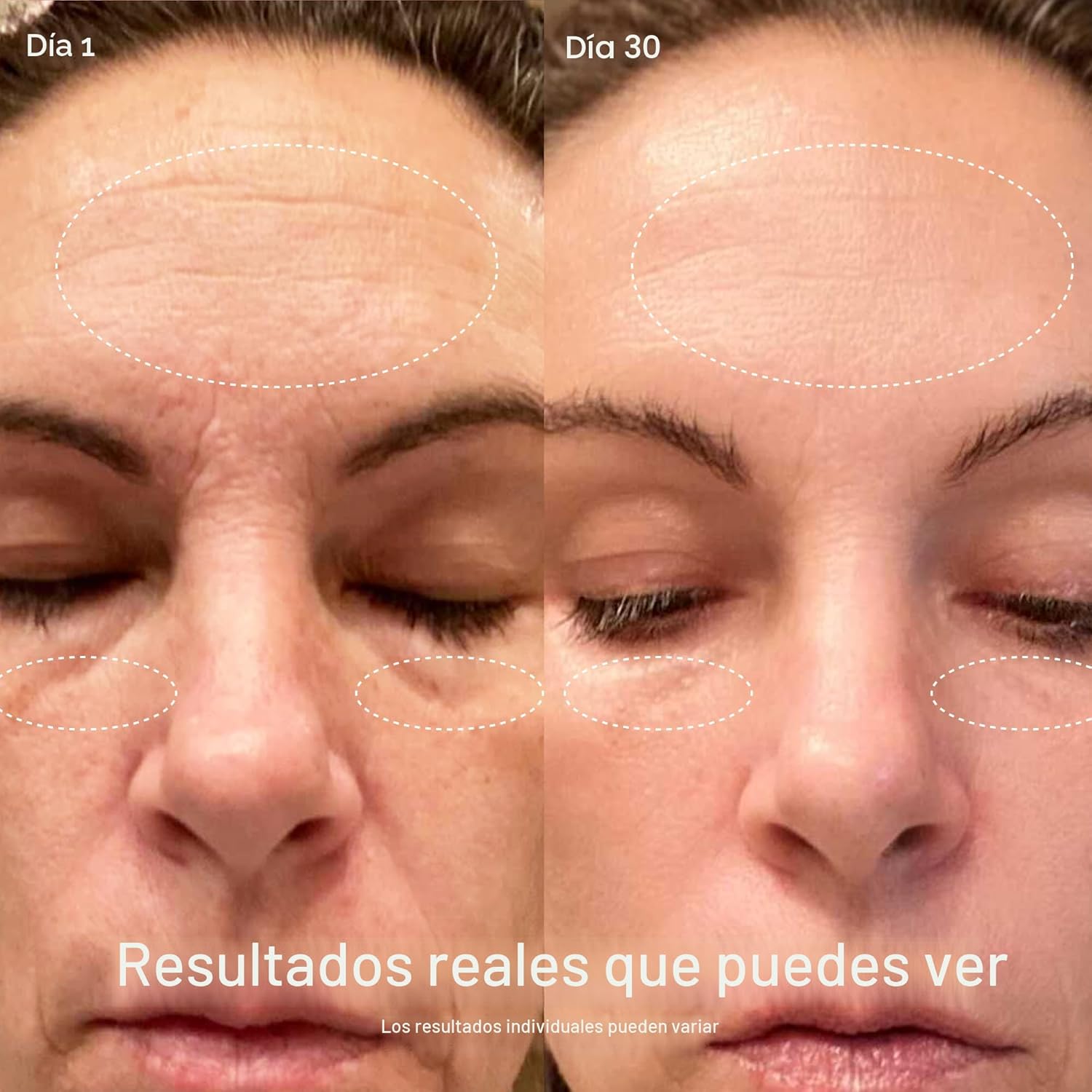 Solawave Varita de terapia de luz roja 4 en 1 para cara y cuello, d...
