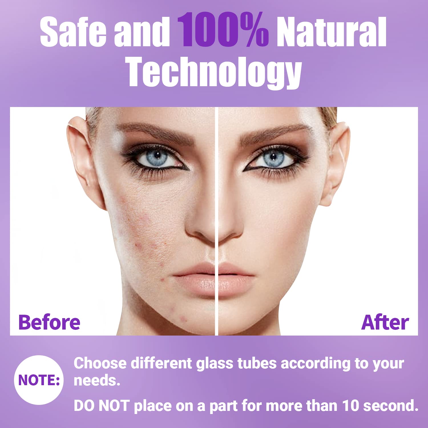 Varita Facial de Alta Frecuencia-UUPAS Máquina Facial Portátil de M...