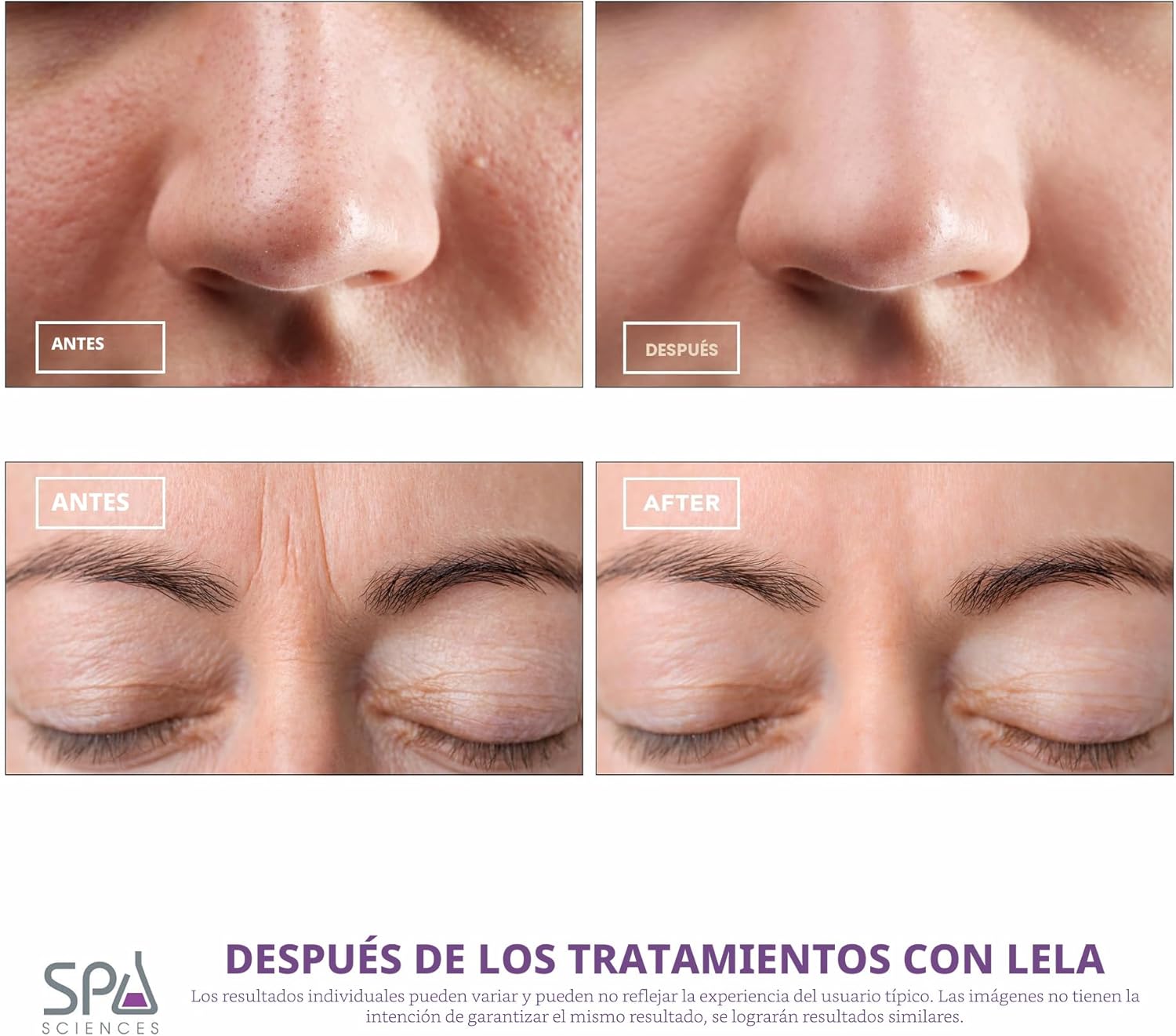 Spa Sciences - LELA - Espátula facial 4 en 1 para limpieza profunda...