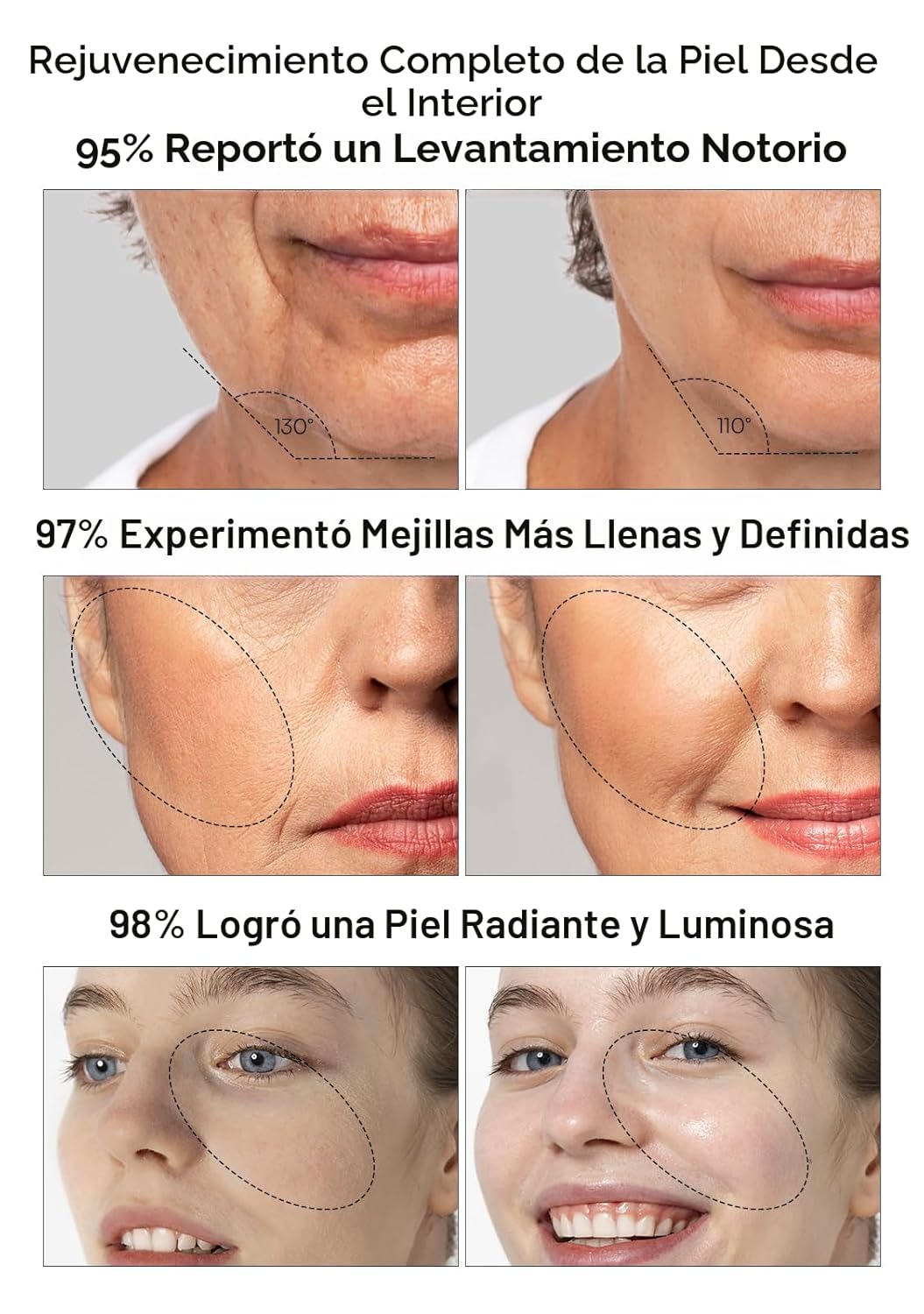 INIA Dispositivo de Reafirmación de Piel 3 en 1 True Beauty Glow Ma...