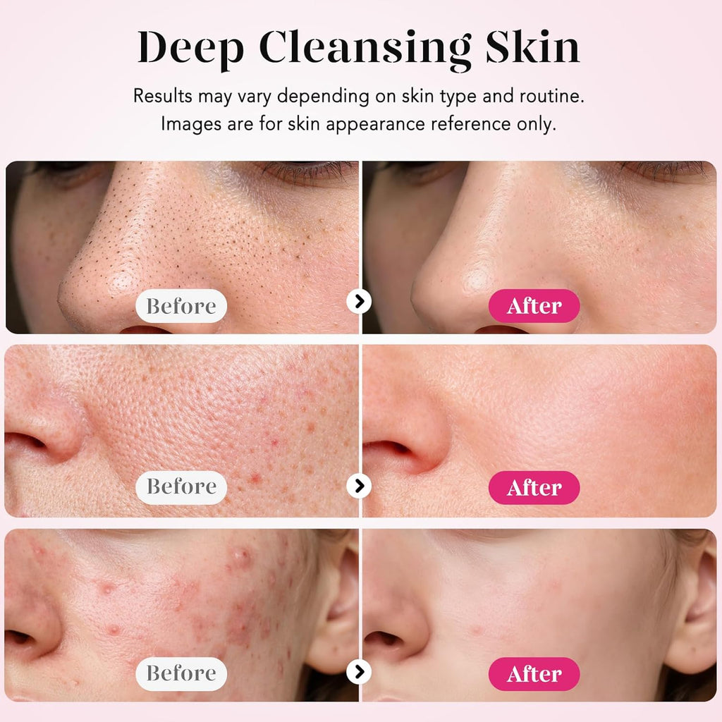 GUGUG Exfoliador de Piel Espátula Facial Espátula para la Piel Limp...