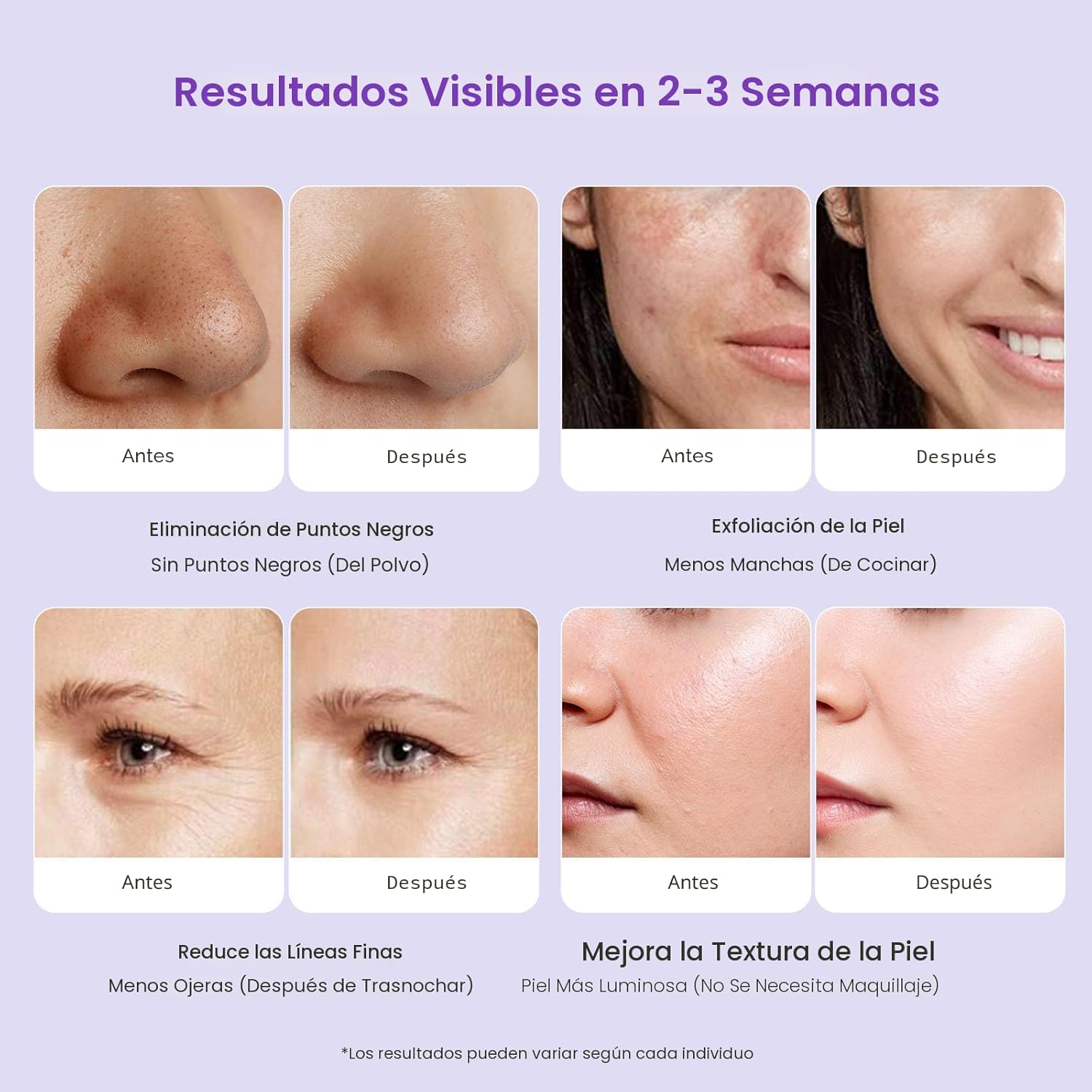 UNOISETION Máquina de microdermoabrasión con diamante profesional,...