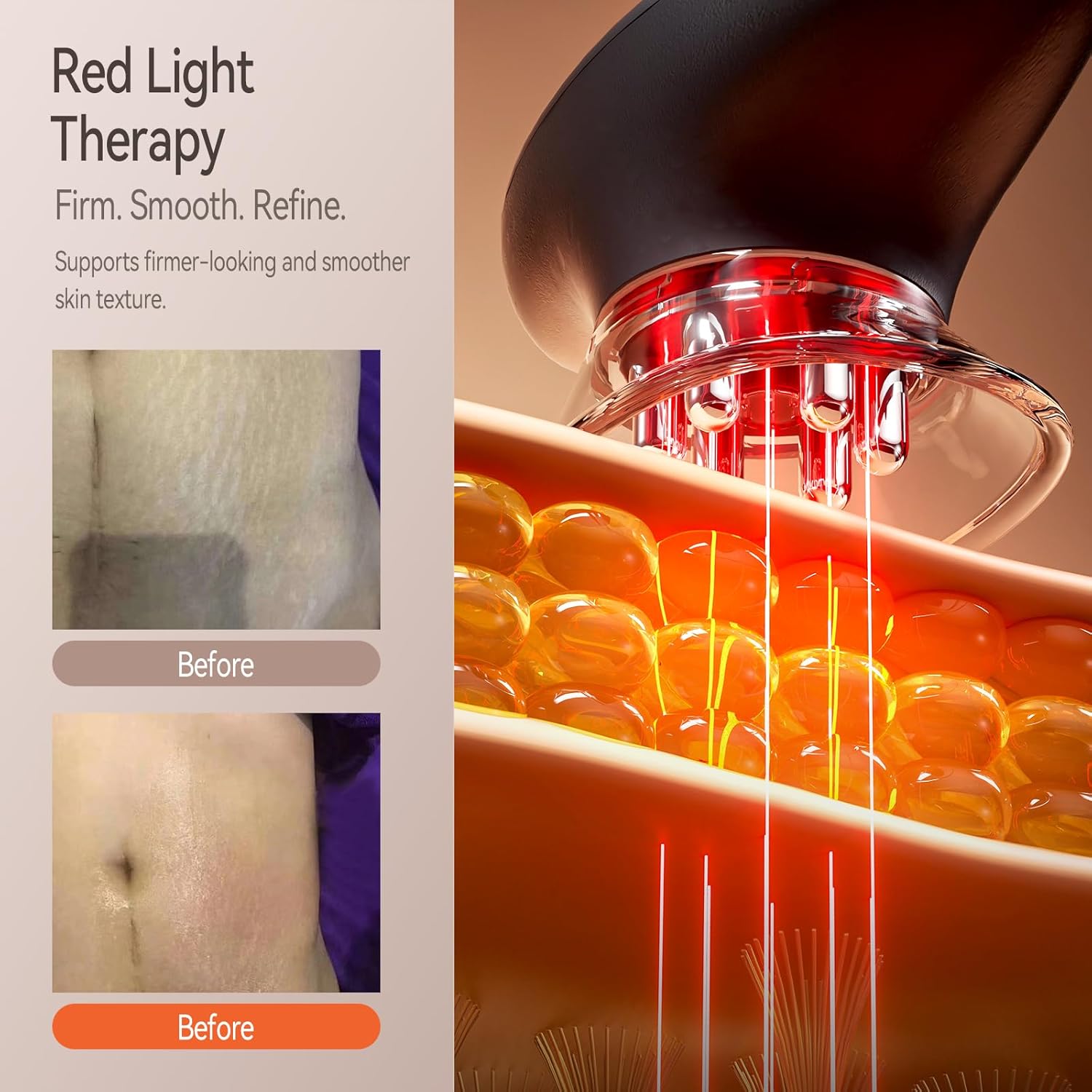 Zelvory Máquina para esculpir el cuerpo 3 en 1 con luz roja, succió...