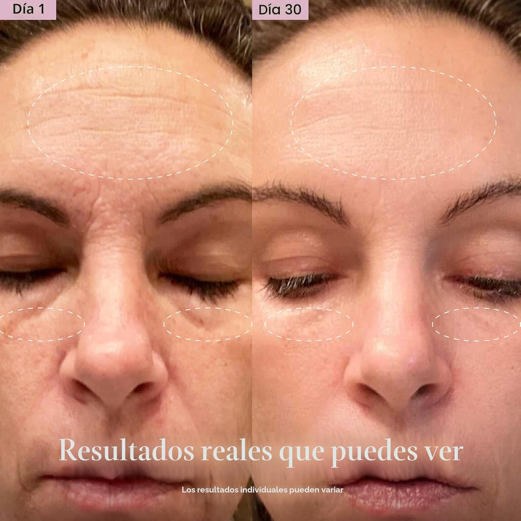 Solawave Varita de Terapia de Luz Roja 4 en 1 para Cara y Cuello |...
