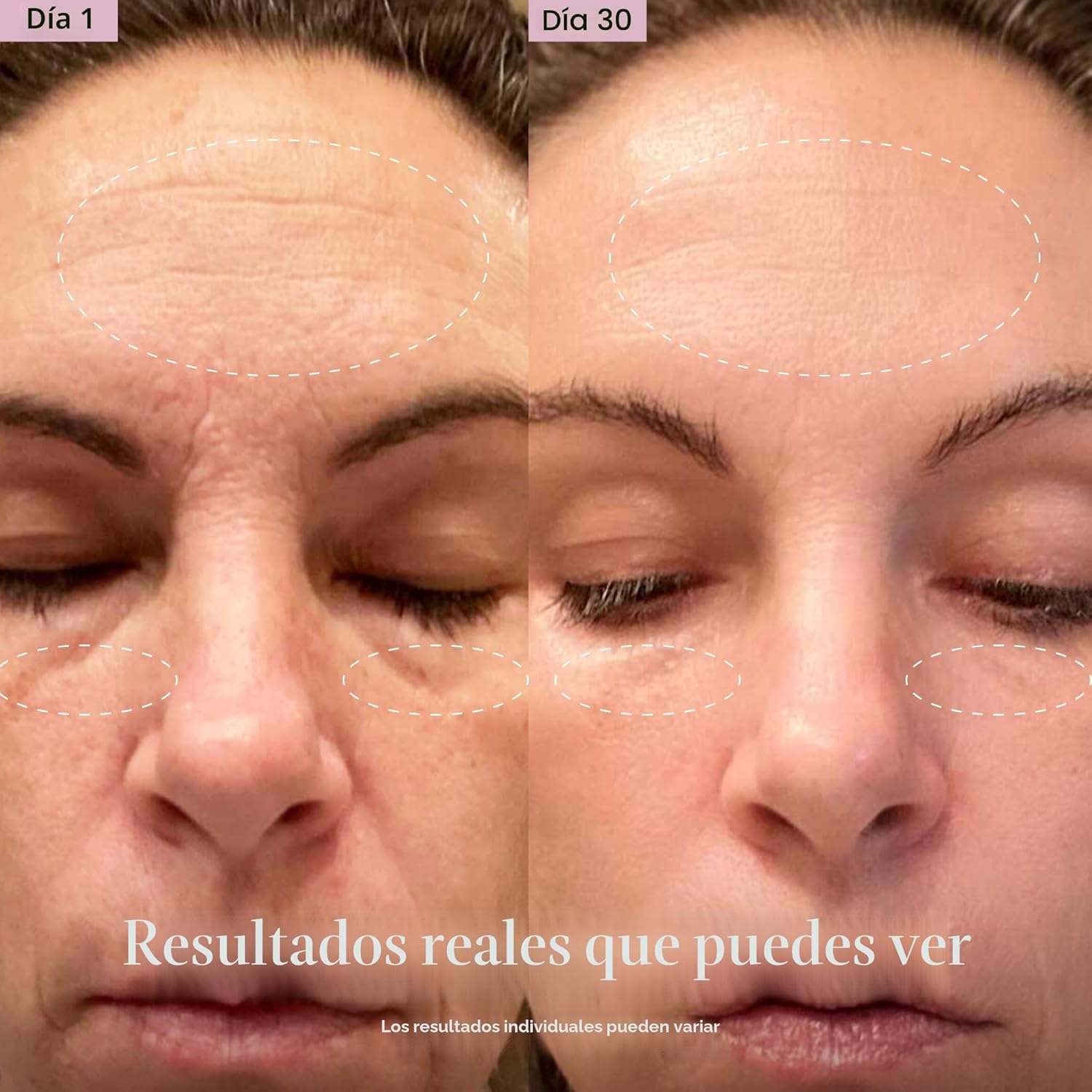 Solawave Varita de Terapia de Luz Roja 4 en 1 para Cara y Cuello |...