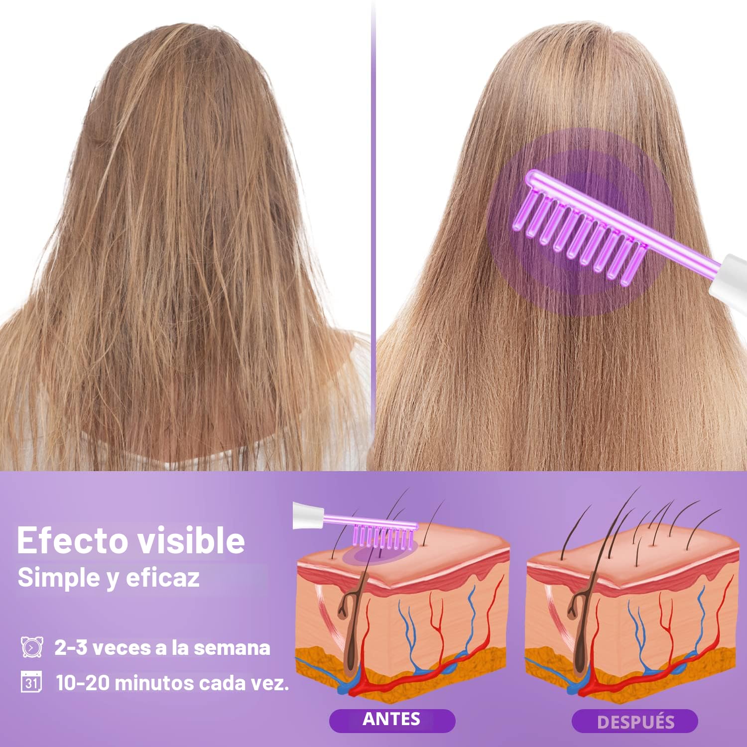 Varita Facial de Alta Frecuencia-UUPAS Máquina Facial Portátil de M...