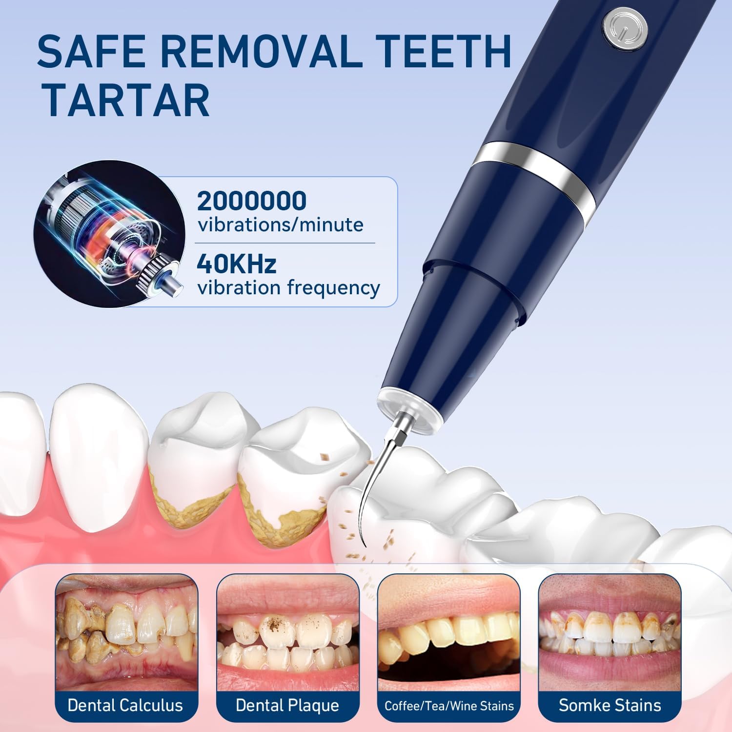 Eliminador de placa\/sarro para dientes, kit de limpieza dental de...