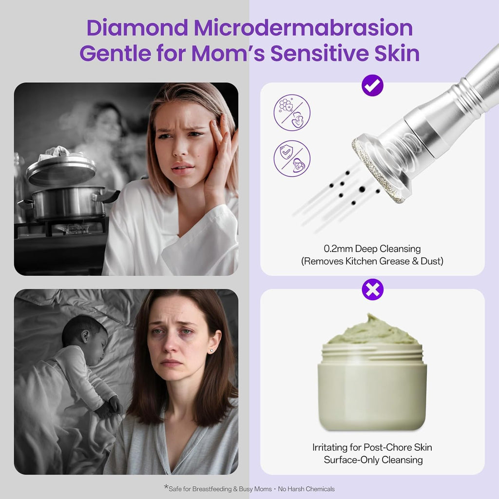 UNOISETION Máquina de microdermoabrasión con diamante profesional,...