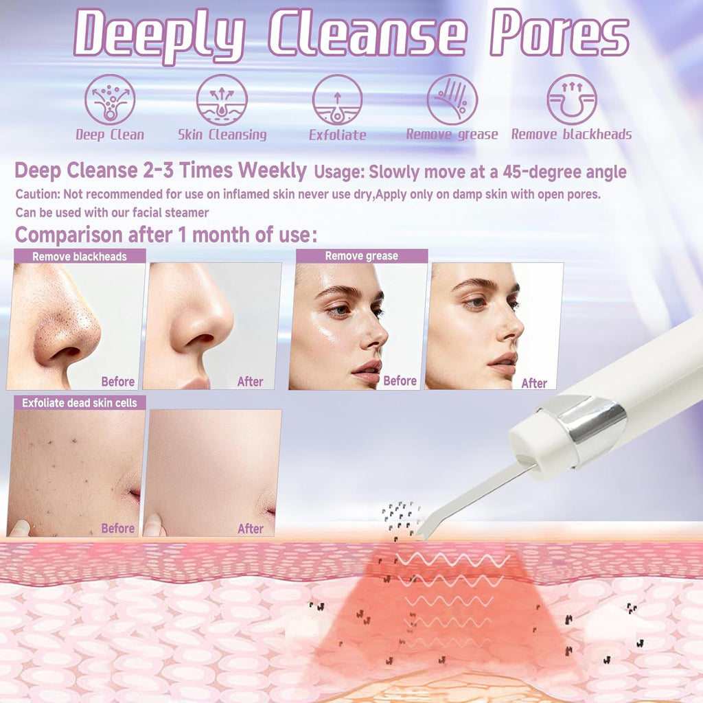 Lixeszt Espátula facial multifuncional limpiador de poros herramien...