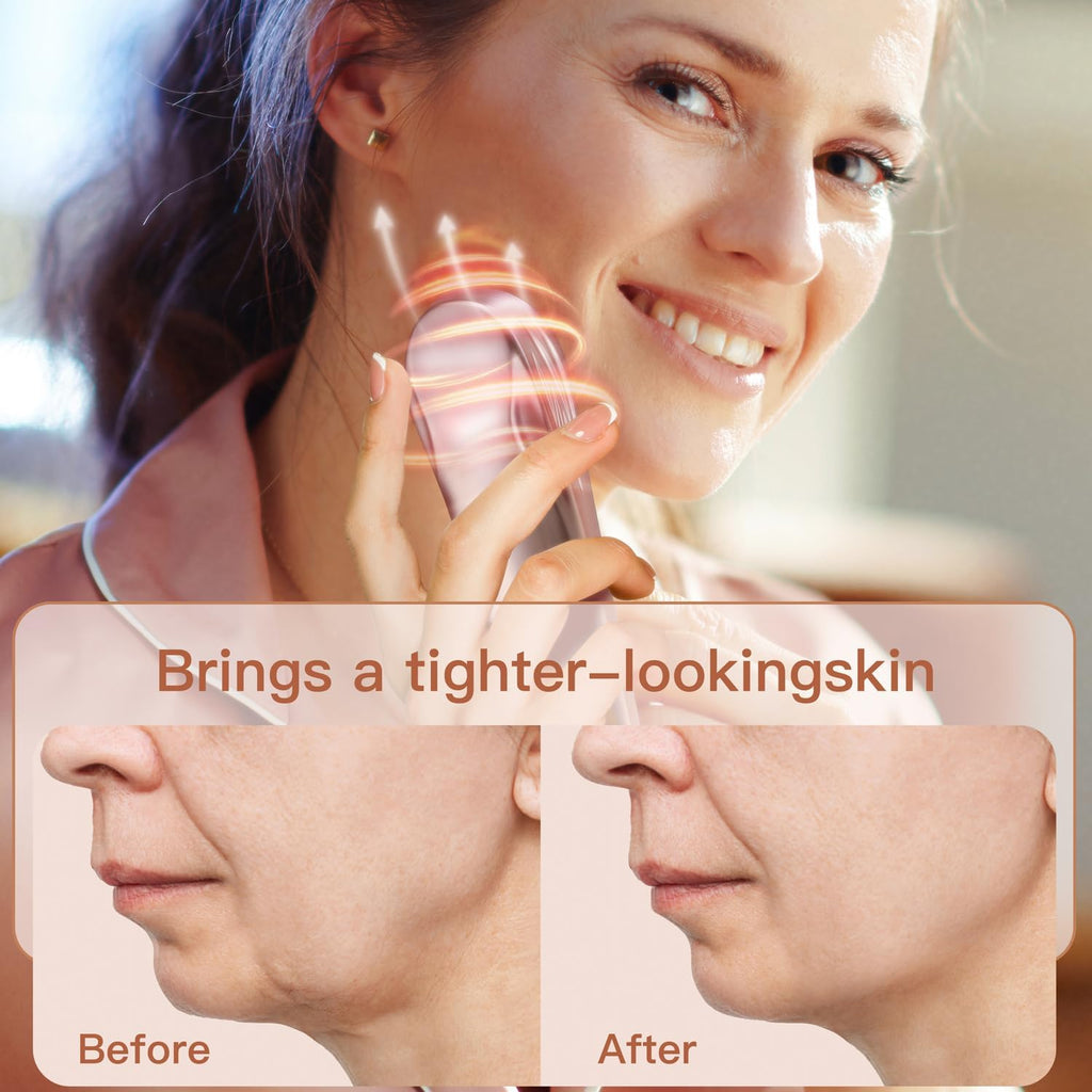 Dispositivo facial de radiofrecuencia | RF profesional 10 vatios |...
