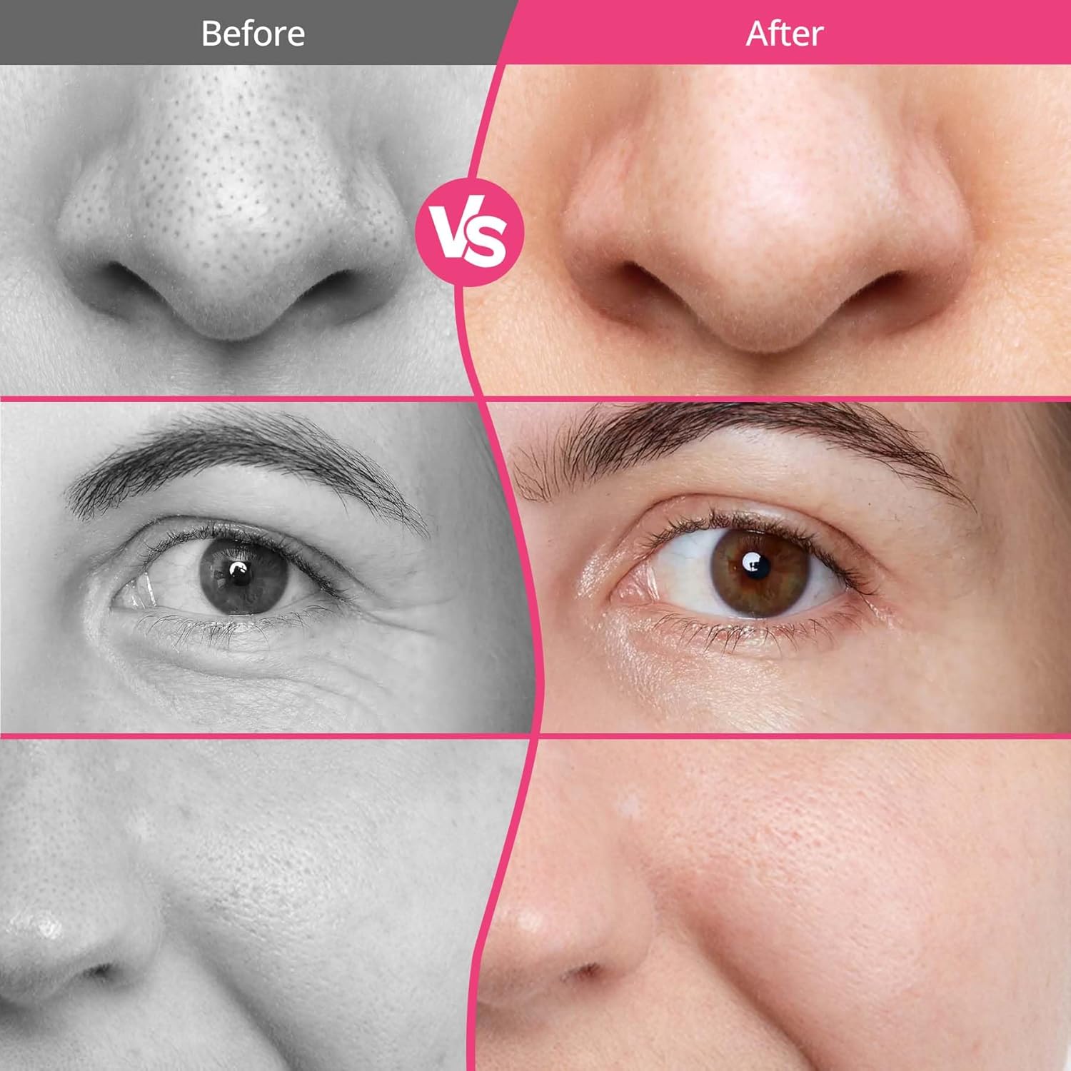 UNOISETION Máquina de microdermoabrasión de diamante, portátil prof...