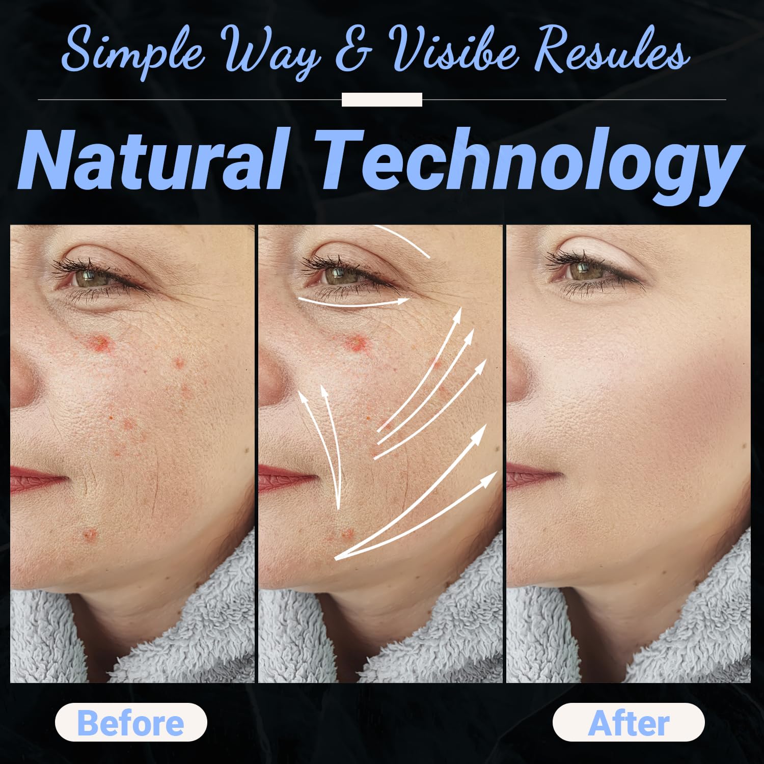 UUPAS - Varita facial de alta frecuencia, portátil de mano 4 en 1,...