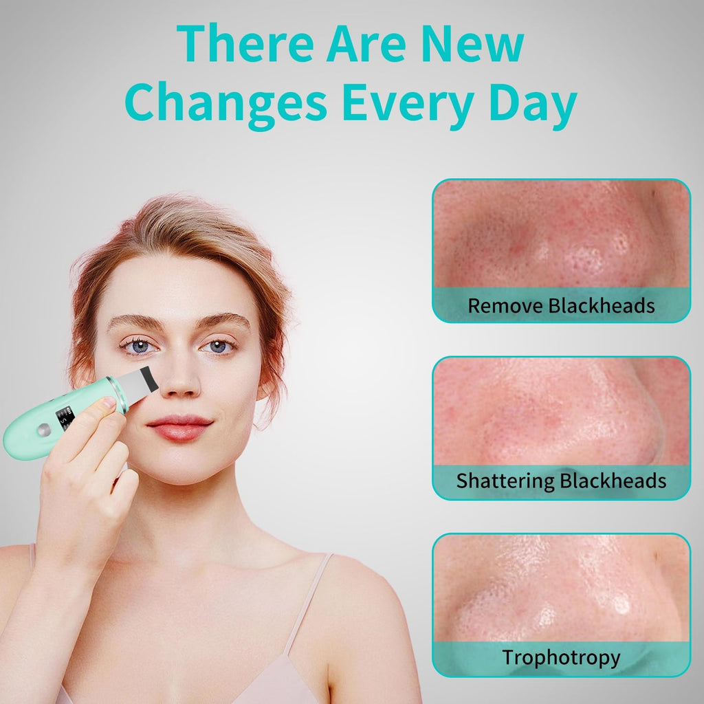 Espátula facial para limpieza profunda - Removedor de puntos negros...