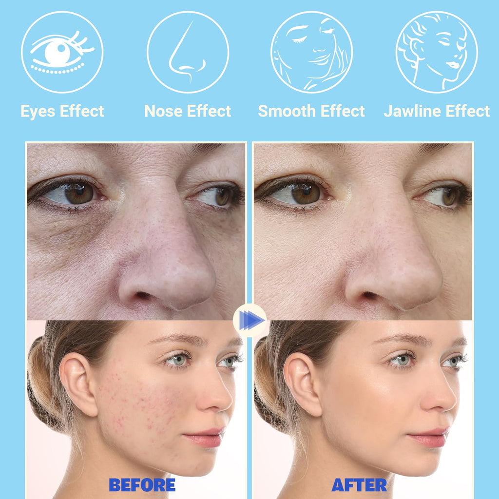Dispositivo facial de alta frecuencia, varita facial TUMAKOU Blue d...