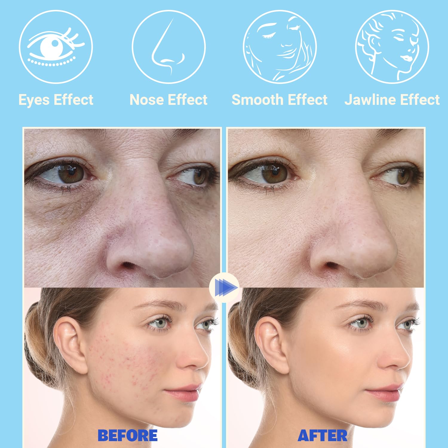 Dispositivo facial de alta frecuencia, varita facial TUMAKOU Blue d...