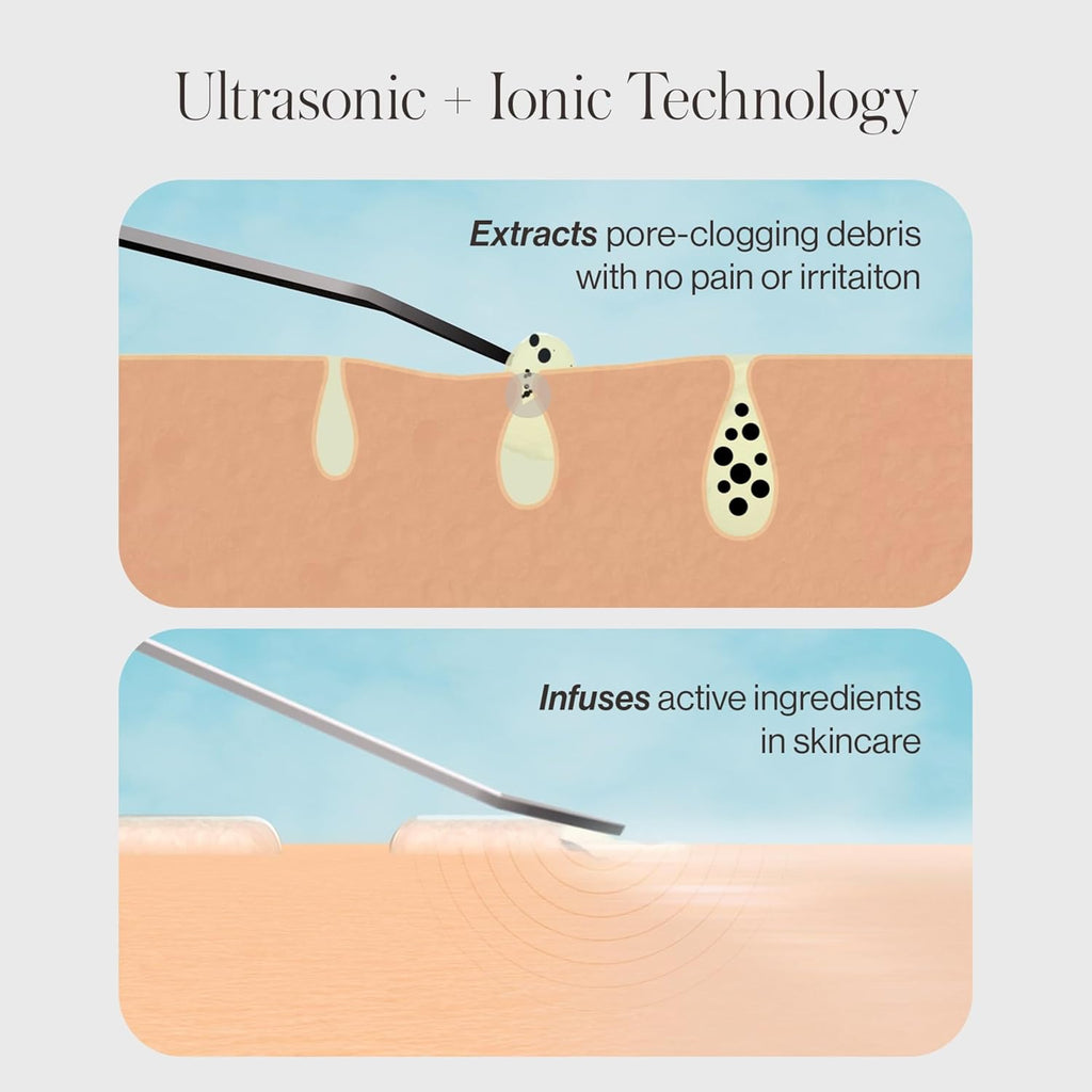 DERMAFLASH DERMAPORE+ Dispositivo de cuidado de la piel, extractor...