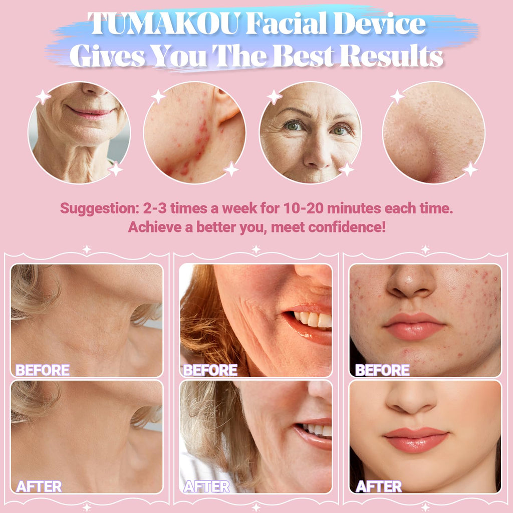 TUMAKOU - Máquina facial de alta frecuencia, portátil de mano de al...