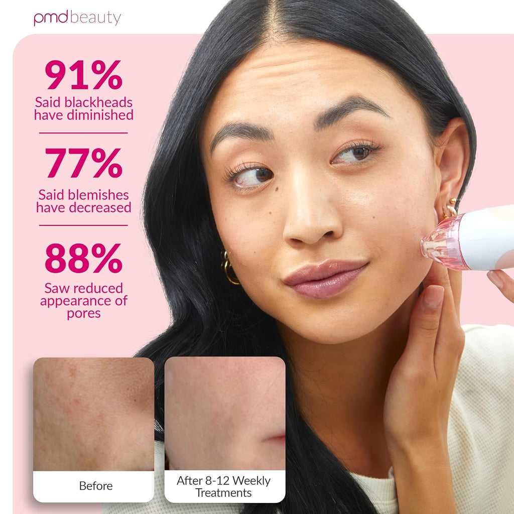 PMD Beauty Personal Microderm Classic - Uso en el hogar, herramient...