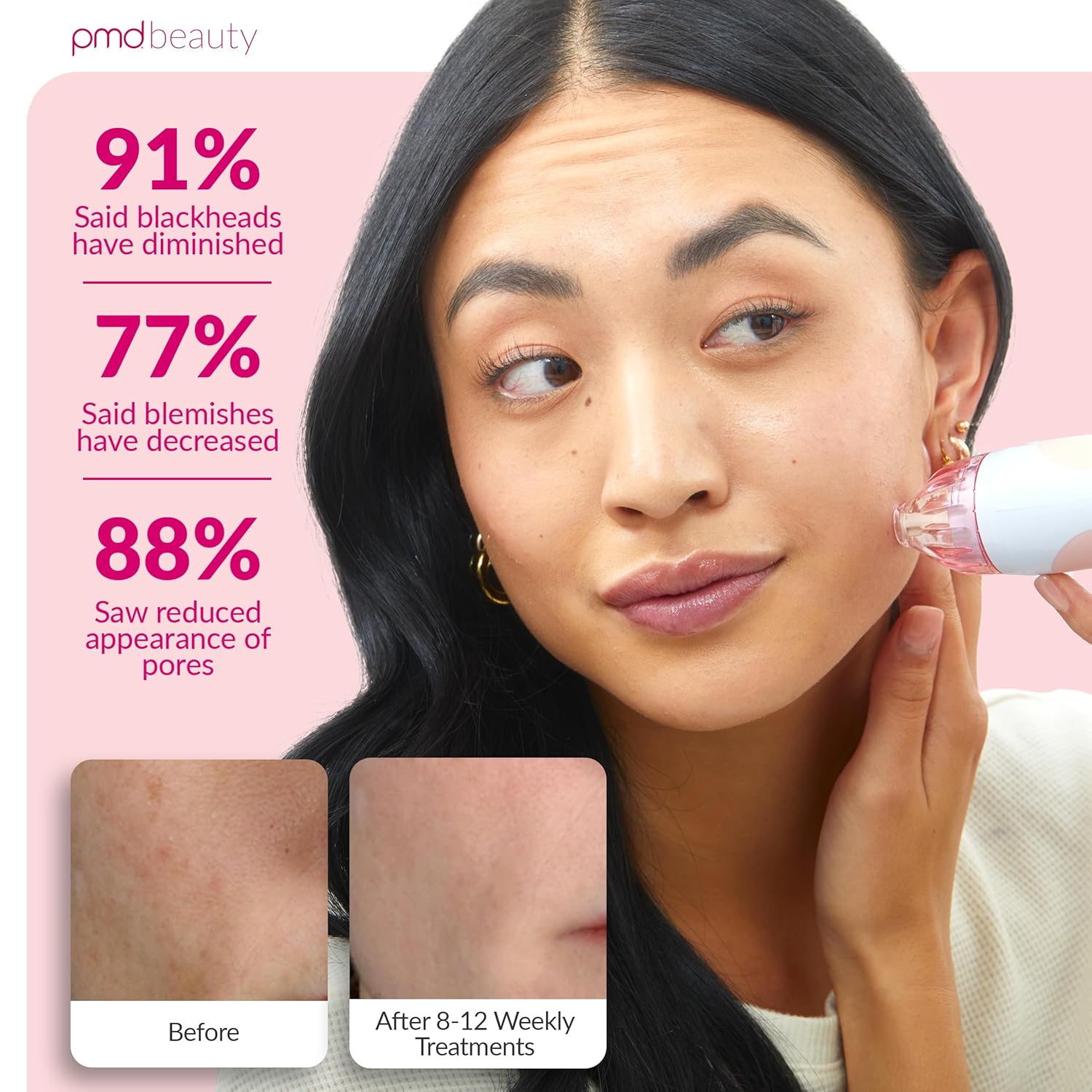 PMD Beauty Personal Microderm Classic - Uso en el hogar, herramient...