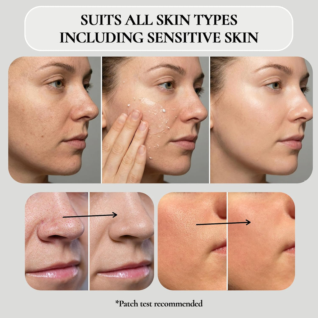 Vivo Per Lei Gel exfoliante facial \u2013 Ayuda a combatir la acumu...