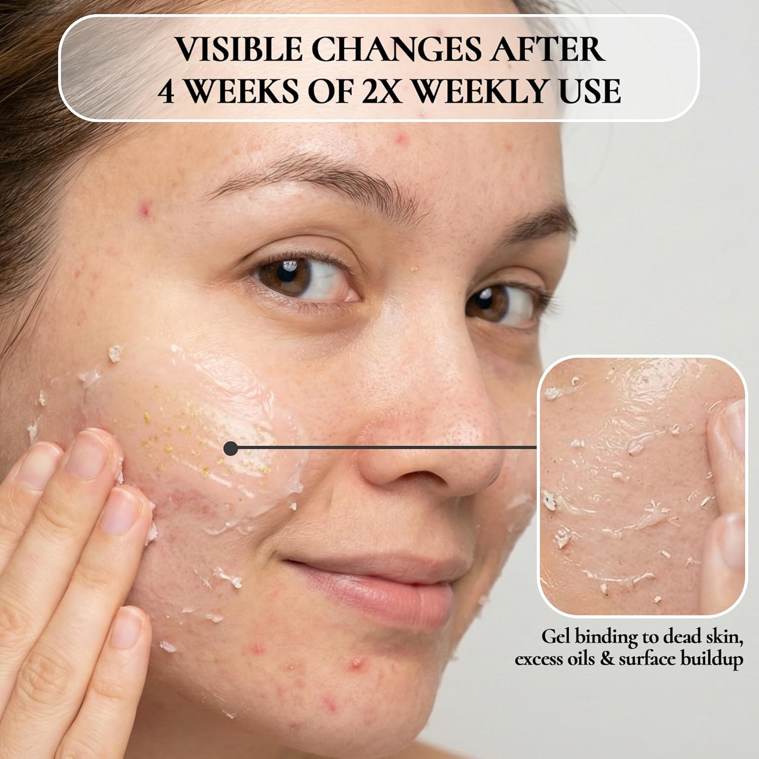 Vivo Per Lei Gel exfoliante facial \u2013 Ayuda a combatir la acumu...