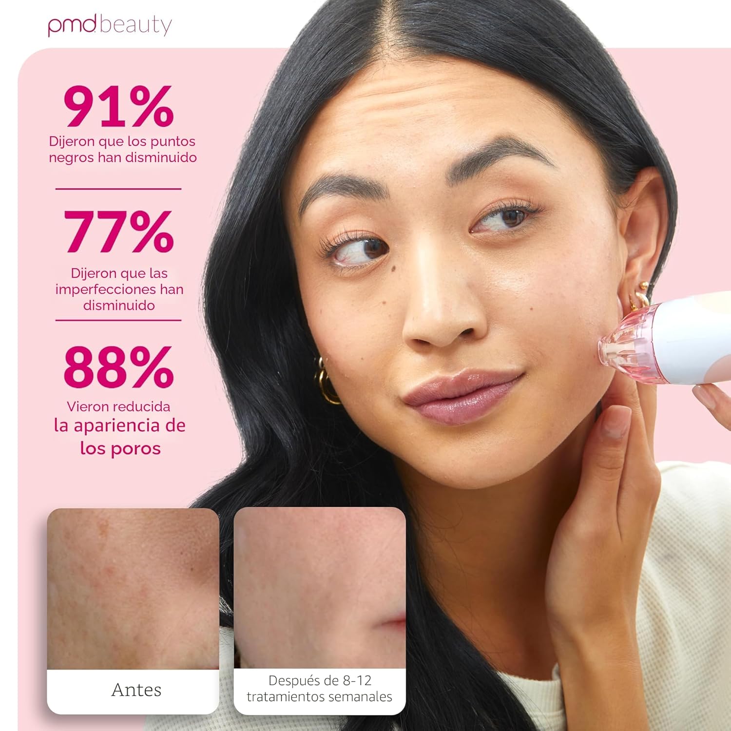 PMD Beauty Personal Microderm Classic - Uso en el hogar, herramient...
