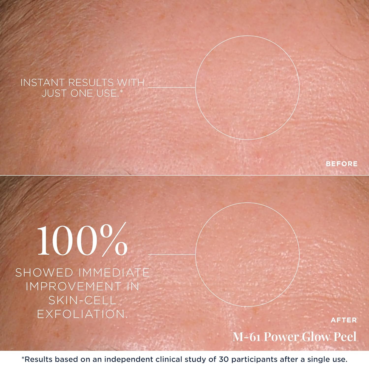 m-61 PowerGlow Peel | Exfoliante Facial Peel Con Ácido Glicólico, S...