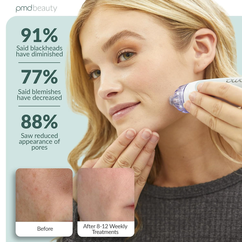 PMD Beauty Personal Microderm Classic - Uso en el hogar, herramient...