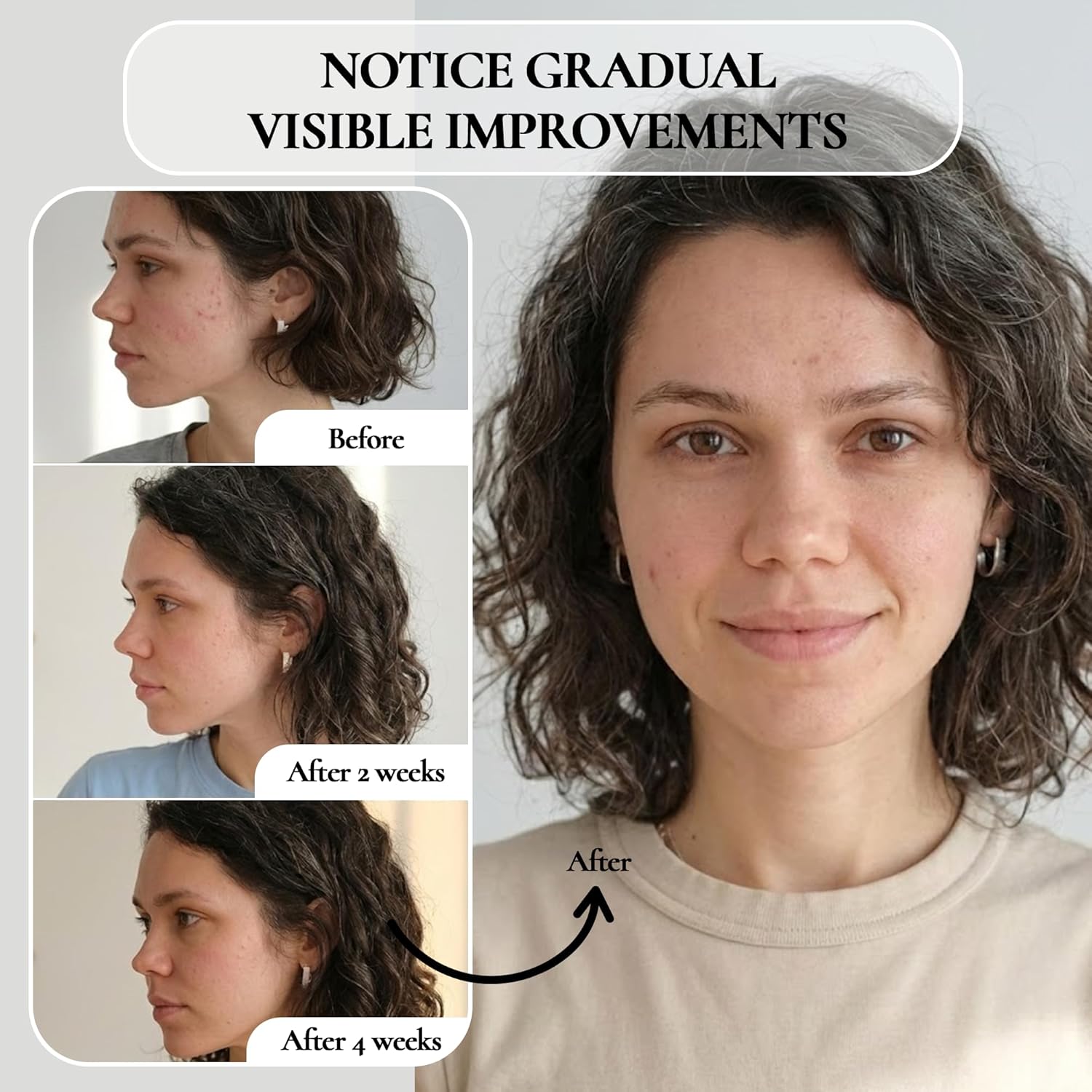 Vivo Per Lei Gel exfoliante facial \u2013 Ayuda a combatir la acumu...