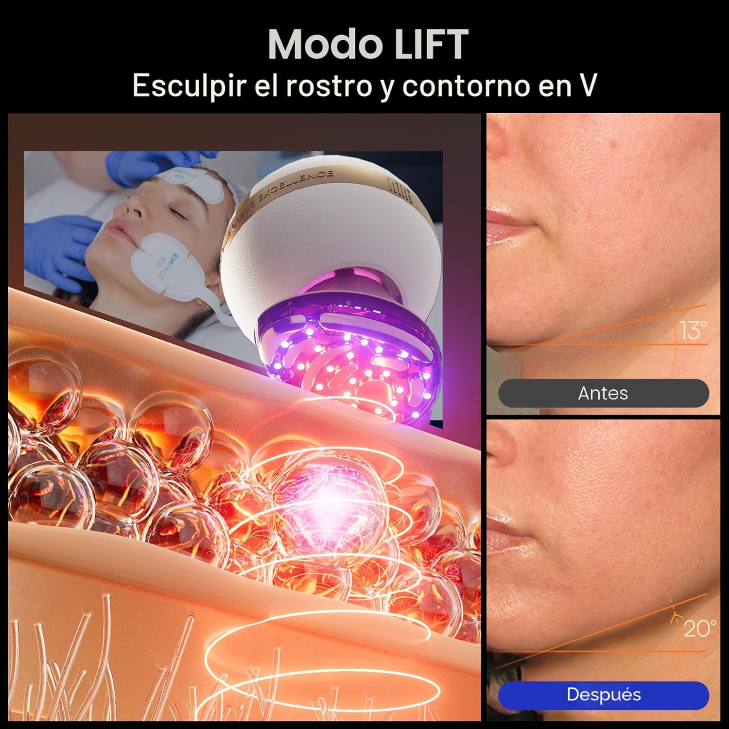 INIA SPHERA Dispositivo facial de microcorriente 8 en 1 mejorado pa...