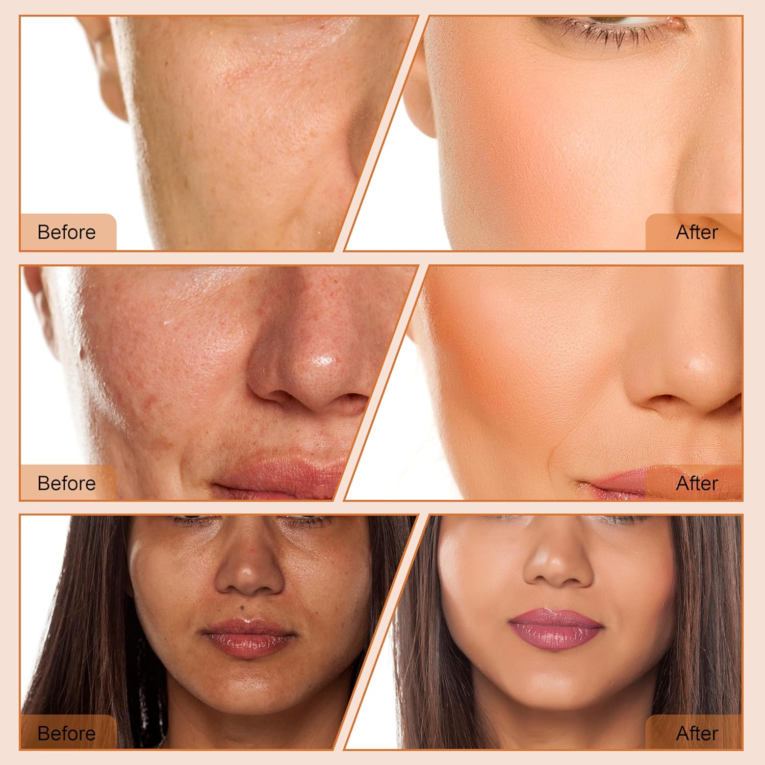 4 en 1 Dermoabrasión de diamante Microdermabrasión Limpiador de la...