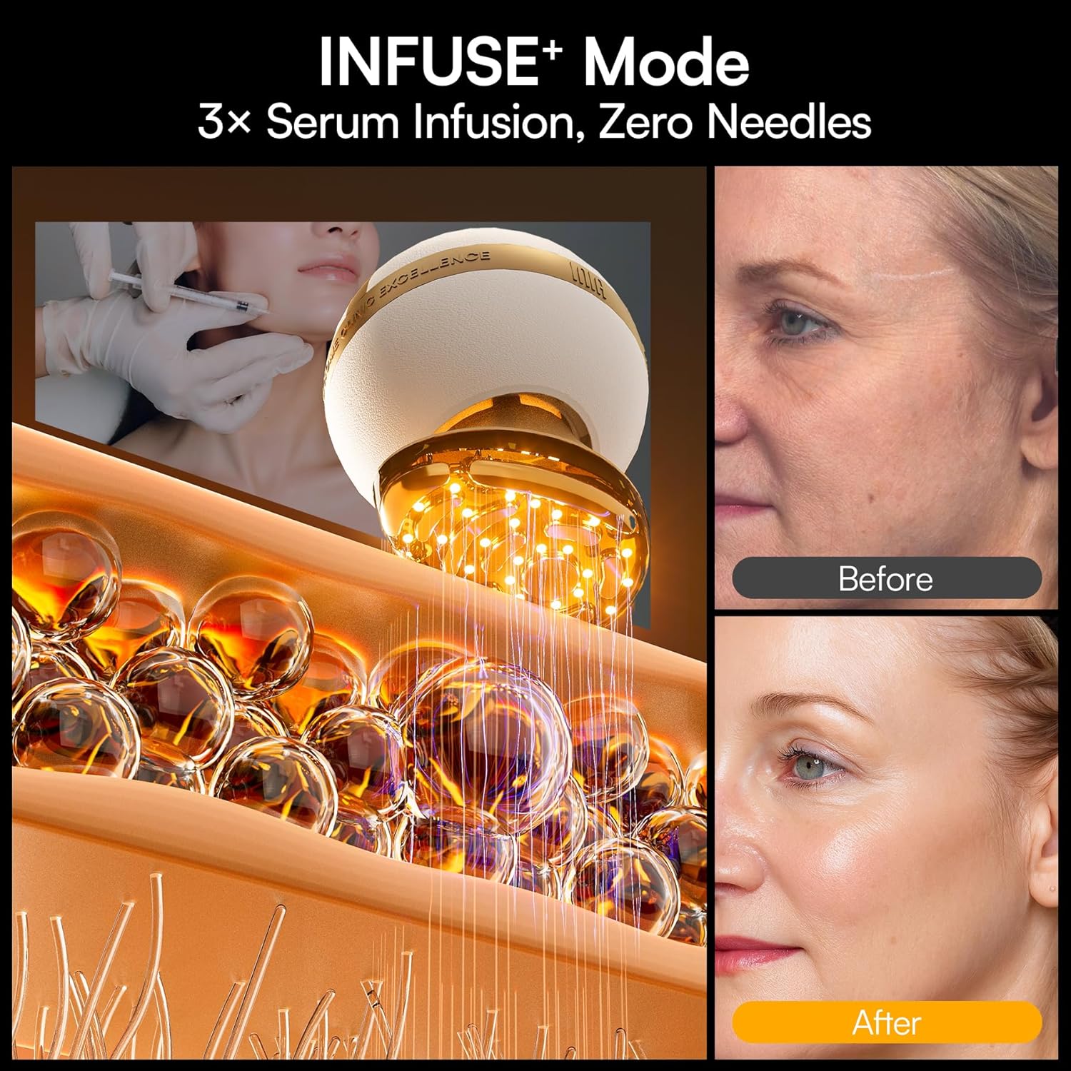 INIA SPHERA Dispositivo facial de microcorriente 8 en 1 mejorado pa...