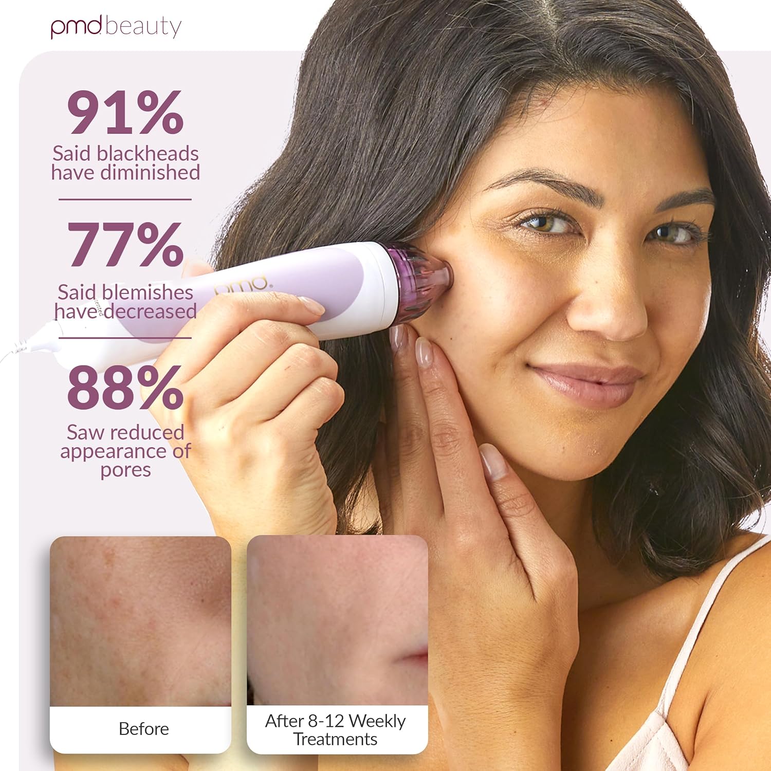 PMD Beauty Personal Microderm Classic - Uso en el hogar, herramient...