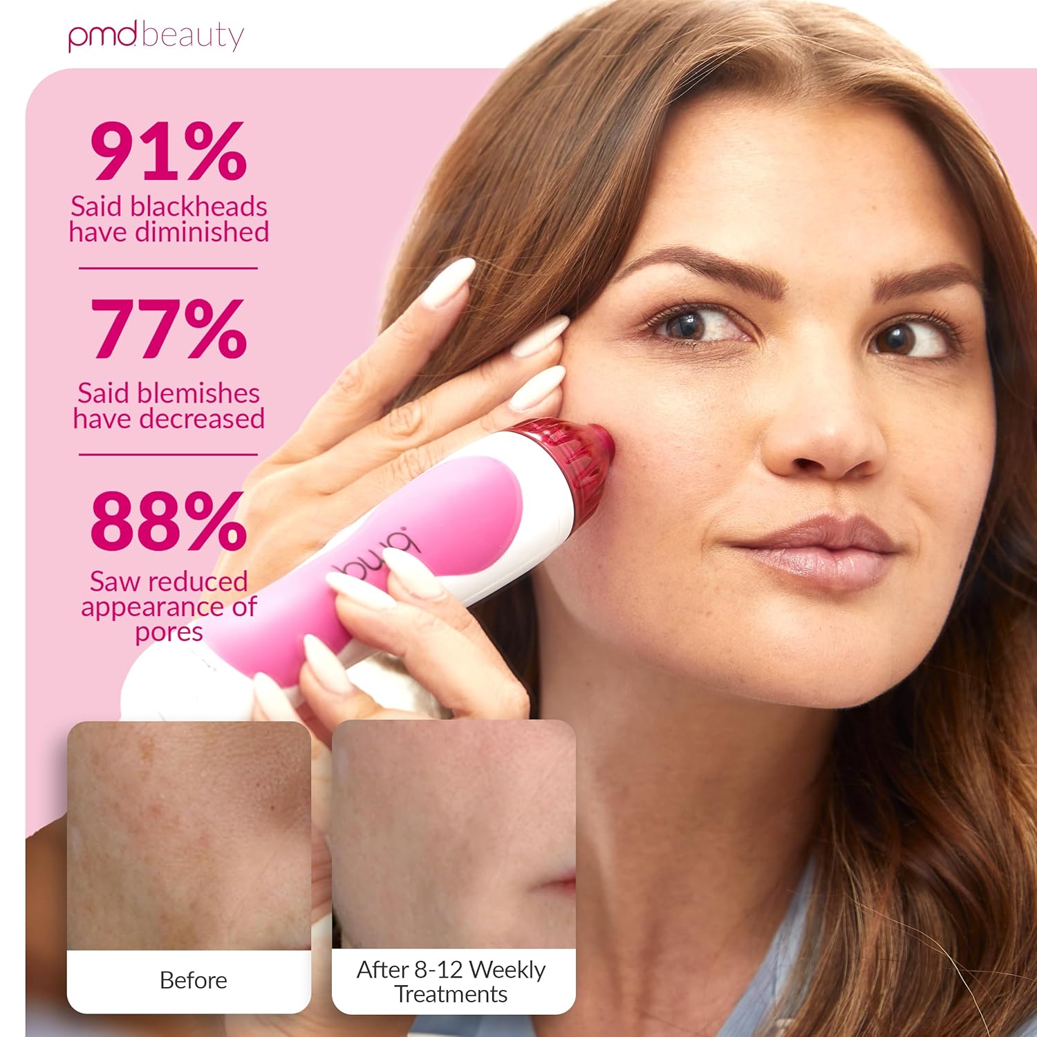 PMD Beauty Personal Microderm Classic - Uso en el hogar, herramient...