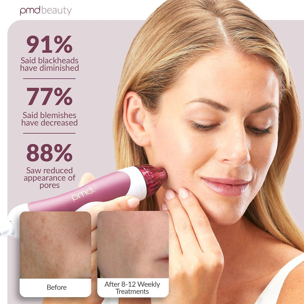 PMD Beauty Personal Microderm Classic - Uso en el hogar, herramient...